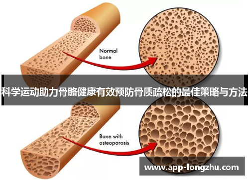 科学运动助力骨骼健康有效预防骨质疏松的最佳策略与方法